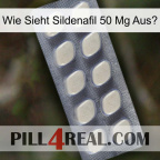 Wie Sieht Sildenafil 50 Mg Ausk 08